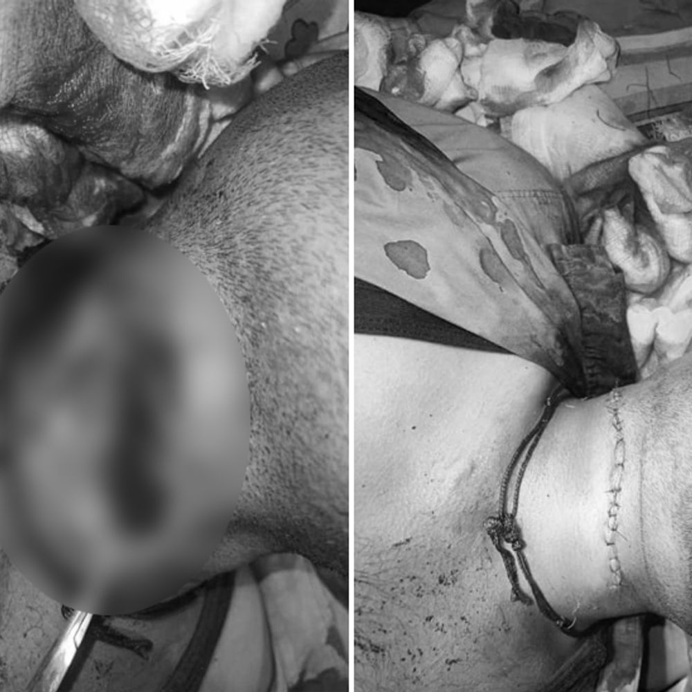 गुजरात में पतंगबाजी से जुड़ी घटनाओं में 15 की मौत:करीब 200 हुए घायल, मरने वालों में 3 और 5 साल के दो बच्चे भी शामिल