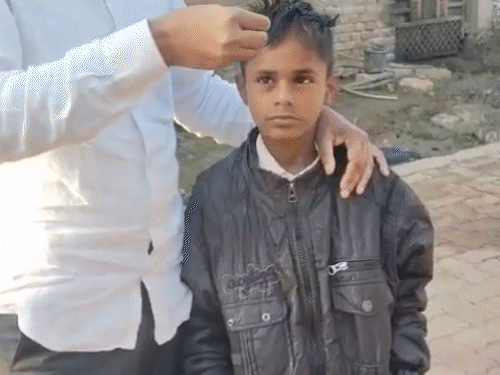महाराष्ट्र के 3 गांवों के 60 लोग अचानक गंजे हुए:3 दिन में झड़े सबके बाल; बच्चों से लेकर बुजुर्ग तक परेशान, सबसे ज्यादा महिलाएं प्रभावित