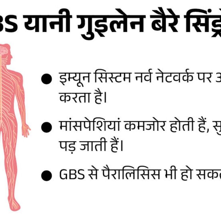महाराष्ट्र में GB सिंड्रोम से 7 दिन में 4 मौतें:60 वर्षीय व्यक्ति की जान गई; राज्य में 140 एक्टिव केस, 20 वेटिंलेटर पर