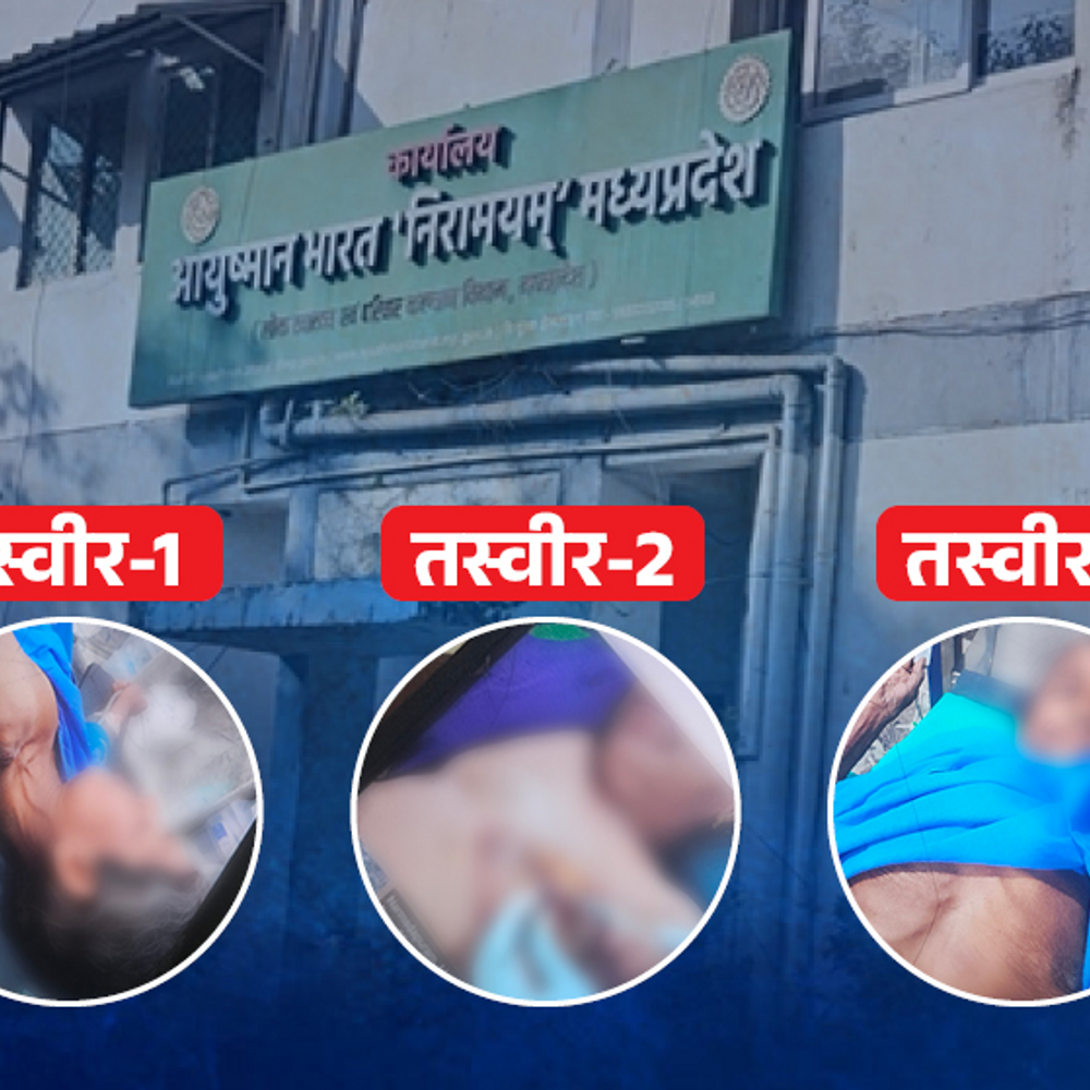 आयुष्मान में ब्रेस्ट सर्जरी कराई तो उसका फोटो जरूरी:नियम पर लेडी डॉक्टर ने आपत्ति ली तो कर्मचारी बोले- क्लेम पास नहीं होगा