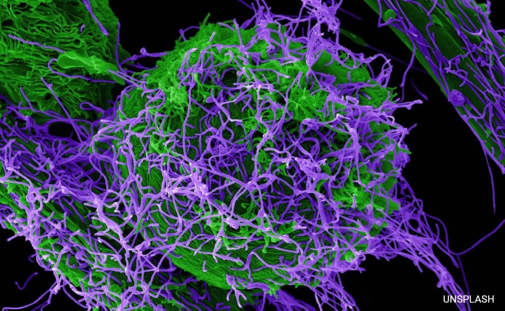 8 Ebola Patients Recover In Uganda, Outbreak "Contained": Minister