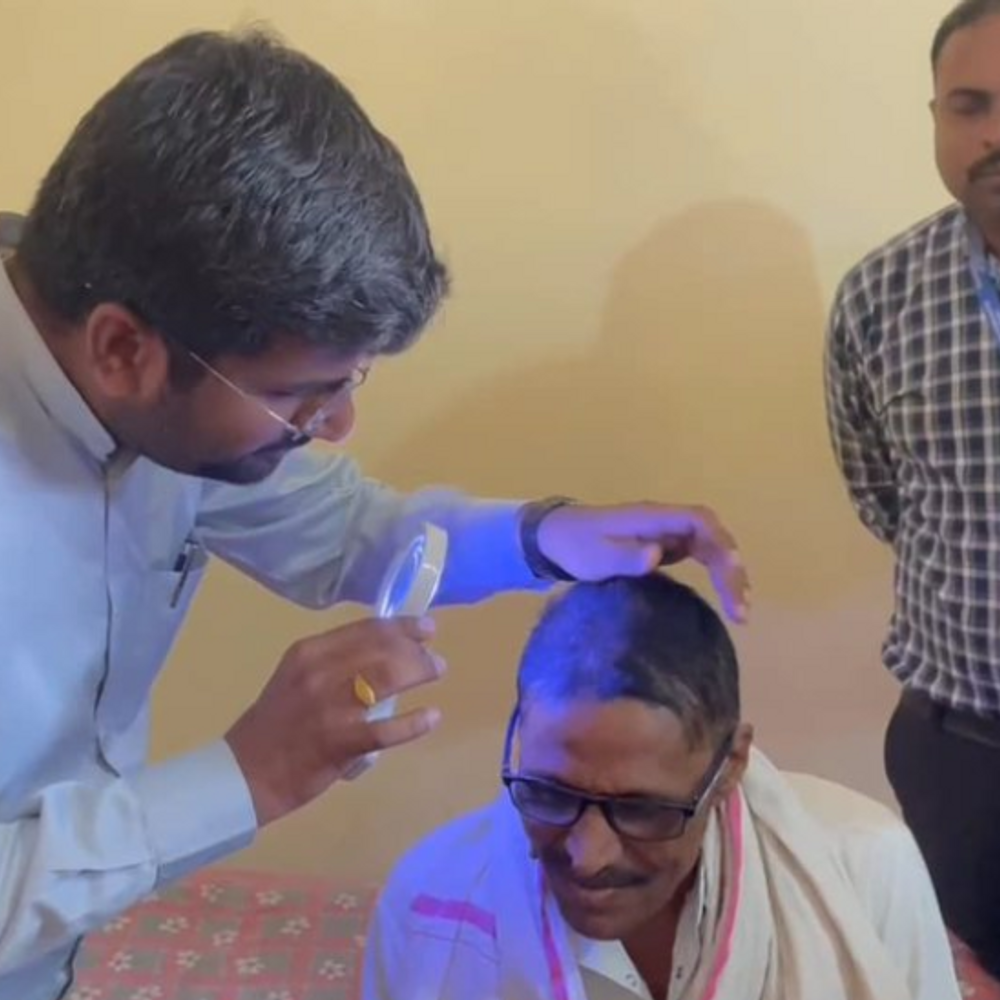 महाराष्ट्र के बुलढाणा में बाल झड़ने की वजह सामने आई:एक्सपर्ट बोले- सेलेनियम वाले गेहूं के इस्तेमाल से फैली बीमारी; 3 महीने में 279 लोग प्रभावित