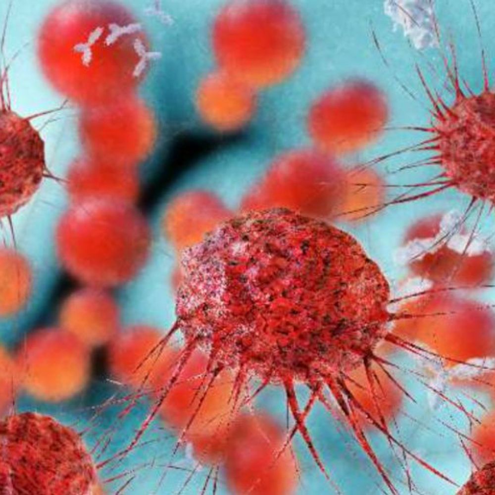 महाराष्ट्र में GB सिंड्रोम के 33 दिन:अबतक 197 संदिग्ध मिले, 172 में इंफेक्शन की पुष्टि और 8 की मौत; सबसे ज्यादा 132 मरीज पुणे से