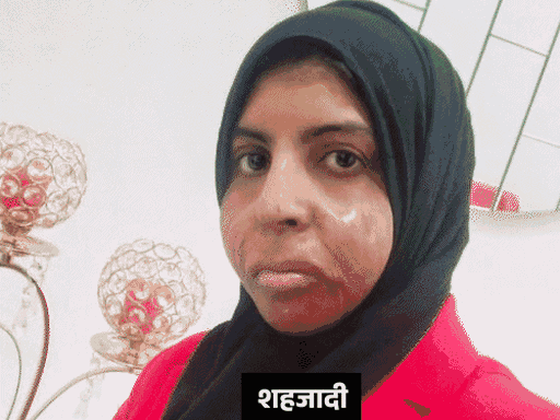 शहजादी के पिता बोले- बेटी का शव तो लौटा दो:मेरे पास इतने रुपए नहीं कि UAE जा सकूं, बांदा की लड़की का शव कल दफन होगा