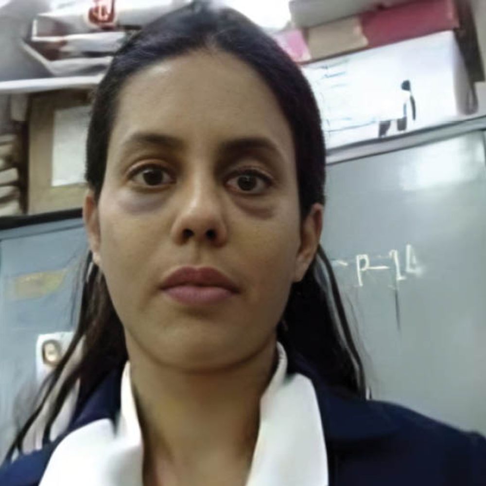 एक्ट्रेस रान्या की गिरफ्तारी के बाद पहली तस्वीर:आंख के नीचे डार्क सर्किल दिखे, DRI बोला- एक साल में 27 बार दुबई गईं