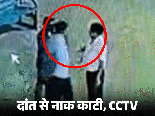 कानपुर में इंजीनियर की नाक काटने वाला डिप्टी डायरेक्टर गिरफ्तार:दांत से इतना तेज काटा कि नाक अलग हो गई, प्लास्टिक सर्जरी होगी