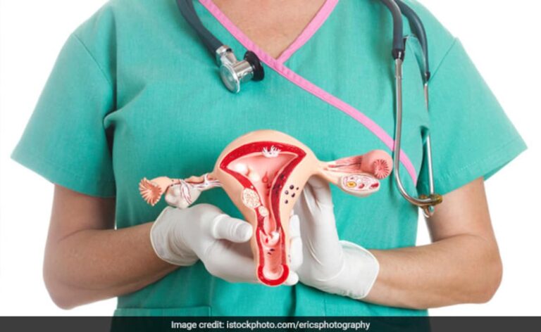 PCOS In Women Tied To Attention, Cognitive Issues: Study