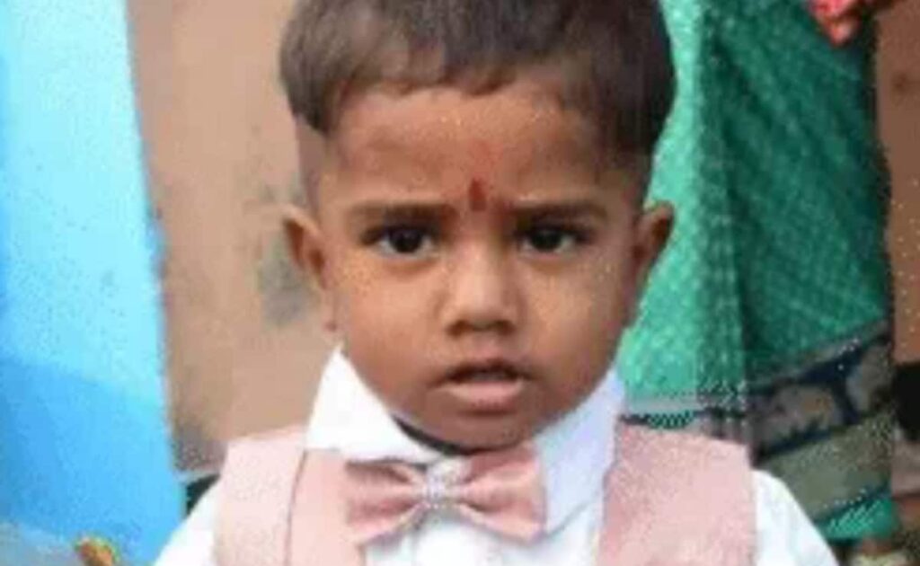 UP Man Throws Axe At Monkeys, It Slashes His Two-Year-Old Son's Neck