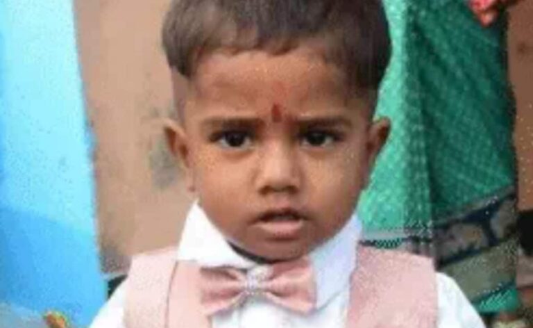 UP Man Throws Axe At Monkeys, It Slashes His Two-Year-Old Son's Neck