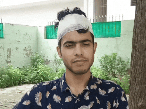 अहमदाबाद विमान हादसा, हरियाणा के स्टूडेंट की आपबीती:पैरों पर लोहे के पिलर गिरे, रेंगते हुए बाहर निकला; मेरे चारों दोस्तों की मौत हुई
