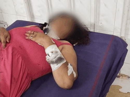 हरियाणा के होटल में लिवइन पार्टनर का गला काटा:शराब की बोतल घुसाई; 17 साल से रिलेशन में थे, छोड़कर विदेश जा रही थी