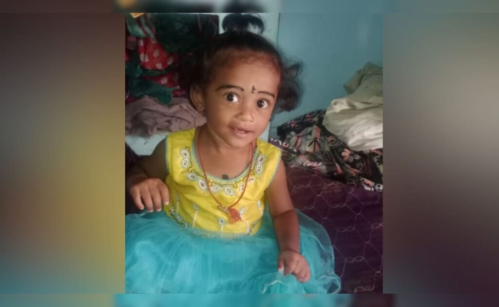 Toddler Dies After Falling Into Pot Of Boiling Milk In Andhra