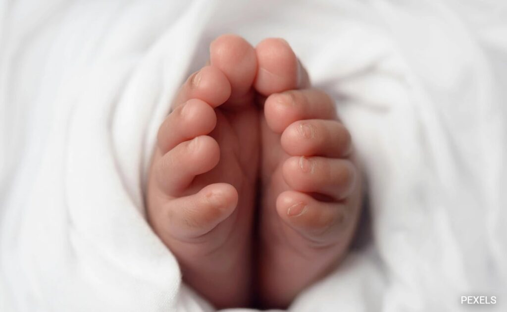 1 In 5,00,000: Newborn In Karnataka Discovered With Twin Growing Inside