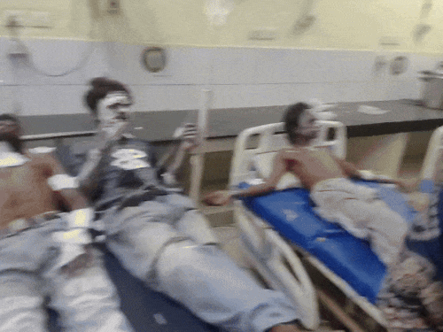 लुधियाना में घर में ब्लास्ट, 10 लोग झुलसे:पटाखे फोड़ते वक्त पोटाश पर गिरी चिंगारी, धमाका हुआ; 5 बच्चे भी चपेट में आए