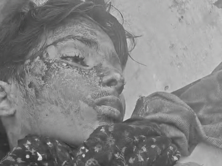 चाइनीज मांझे से कटी गर्दन, 8वीं के छात्र की मौत:इंदौर में भाई-दोस्तों के हाथ में आई चोट; 4 दिन पहले ही बैन किया था