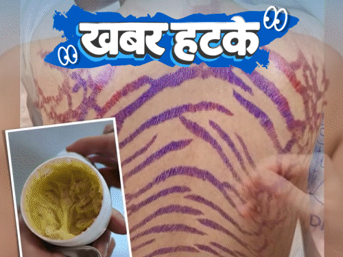 खबर हटके- क्रीम लगाने से सांप जैसी बनी महिला:अंगूठी पहनने के लिए हर दिन 2.5 लाख रुपए मिल रहे; देखिए 5 रोचक खबरें