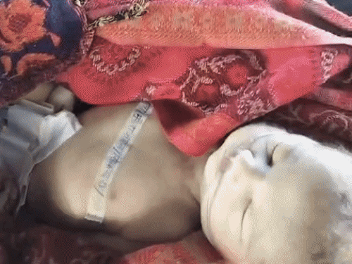 जयपुर-एम्बुलेंस के कारण बच्चे की मौत, सीना दबाता रहा पिता,VIDEO:ऑक्सीजन खत्म हुई, तड़प-तड़प कर दम तोड़ा, पुलिसवालों ने लाश के साथ बस में बैठाया